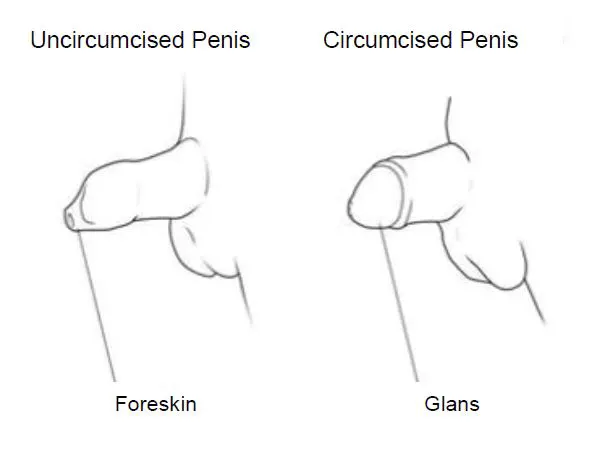 How much does foreskin surgery cost in India? - Circumcision Doctors